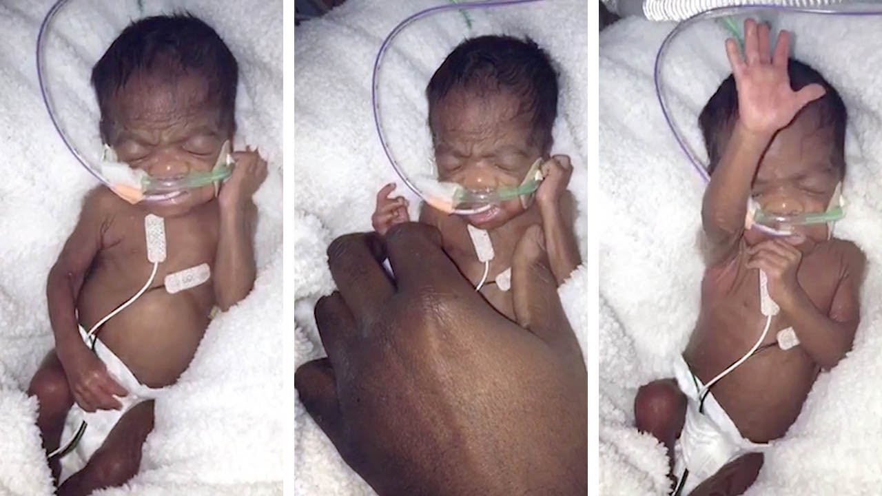Premature Baby Pushes Mums Hand Away