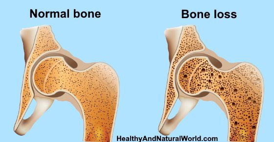 how-to-increase-bone-density-and-build-healthy-bones-including