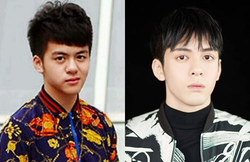 Did Joseph Zeng Undergo Plastic Surgery?