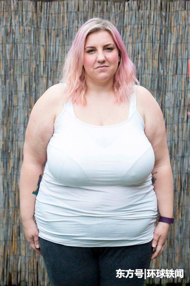 因担心哺乳令孩子窒息, 英国女子希望缩小胸部