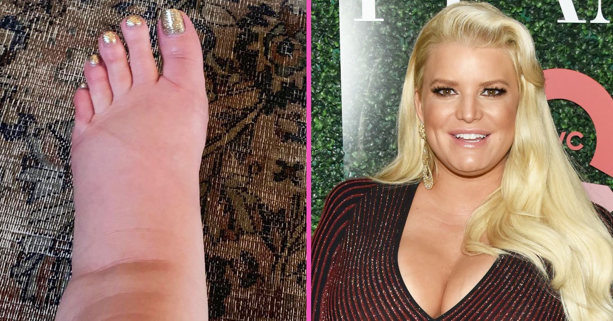 ‘I Spy… My Ankles!’: Jessica Simpson Shares Post-Pregnancy Foot Pic