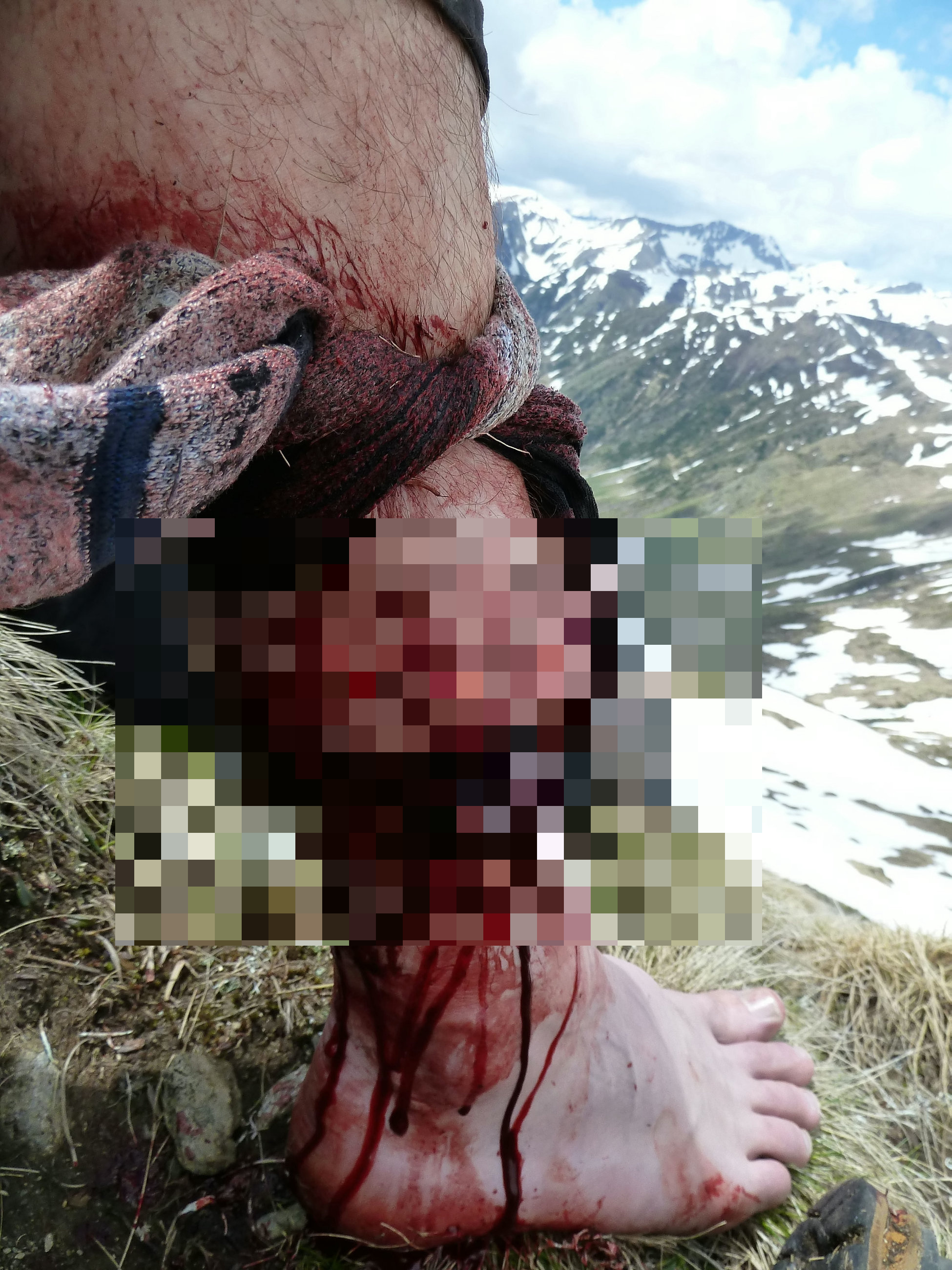 Man Survives Bear Attack By Punching It In The Face