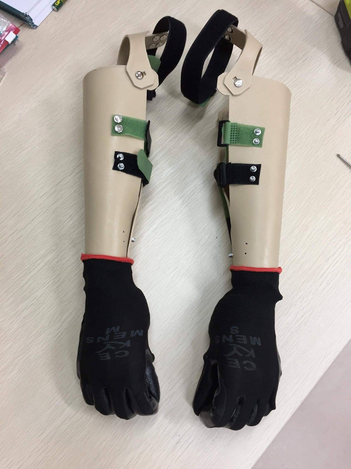 A 3D-printed ‘arm’ could be the helping hand amputee Tan Whee Boon needs to land a job