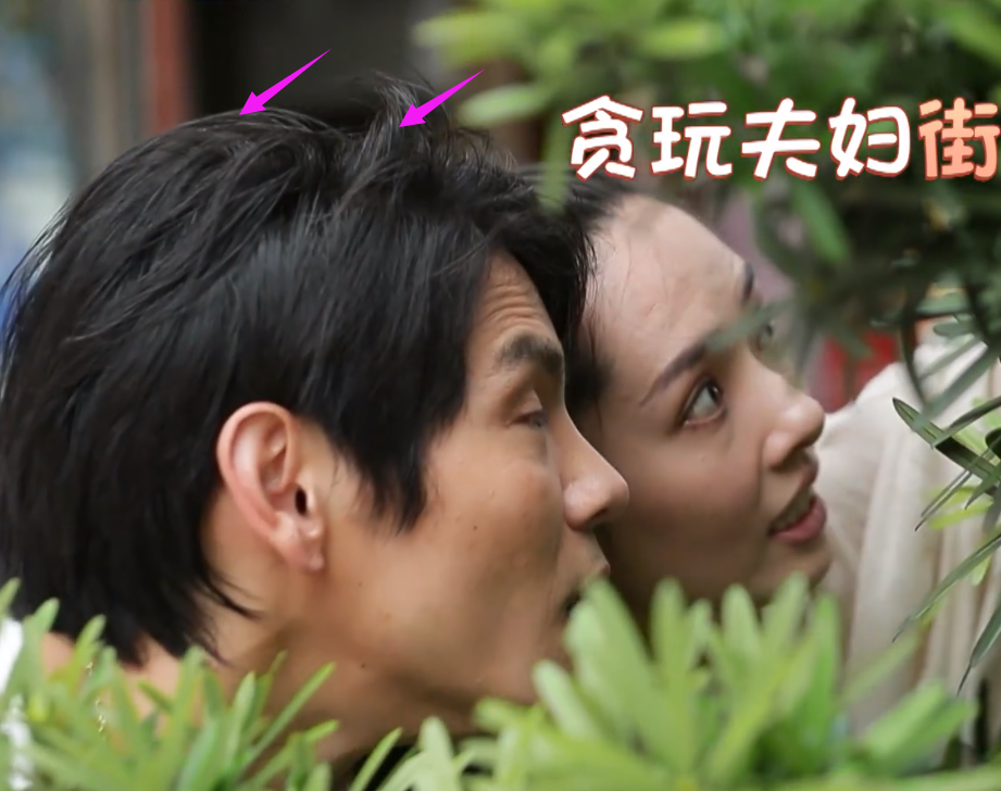 郭碧婷扎马尾辫超高发际线太吸睛，去掉滤镜后，脸上都是小坑坑！