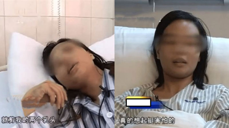 被误认小三 女子乳头被剪、下体遭刺！