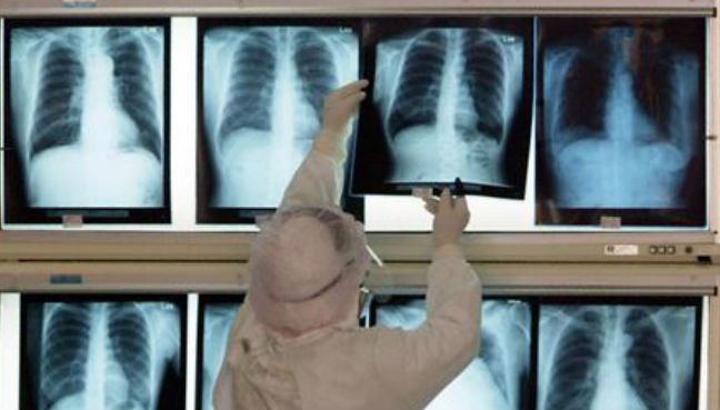 20,000 medical records of Malaysians found to be freely available online