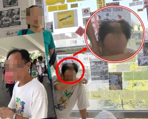马鞍山「撕纸」中年汉疑遭人淋泼液体 妻被抢电话