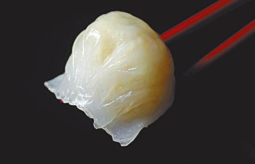 点心之王　虾饺