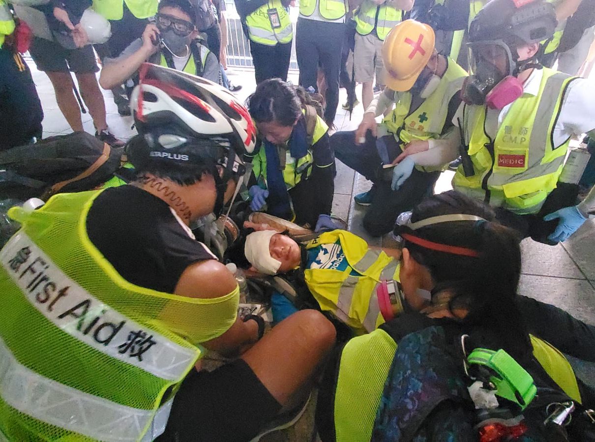 【修例风波】代表律师引述医生称：印尼女记者右眼将永久失明