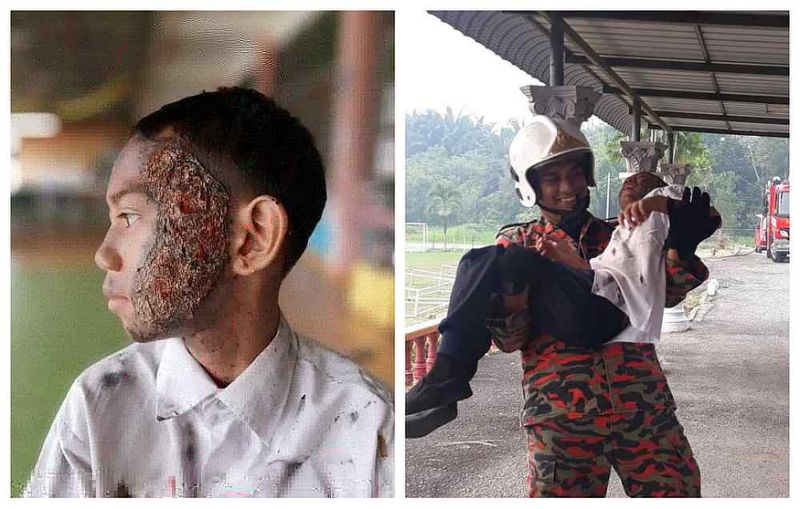 Negri teacher takes fire drill to next level with realistic burn makeup effects