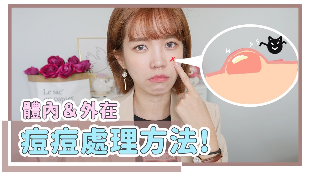 突然冒痘怎么办？我的「内外」救急保养法｜居妮Ginny Daily X DermaAngel♥