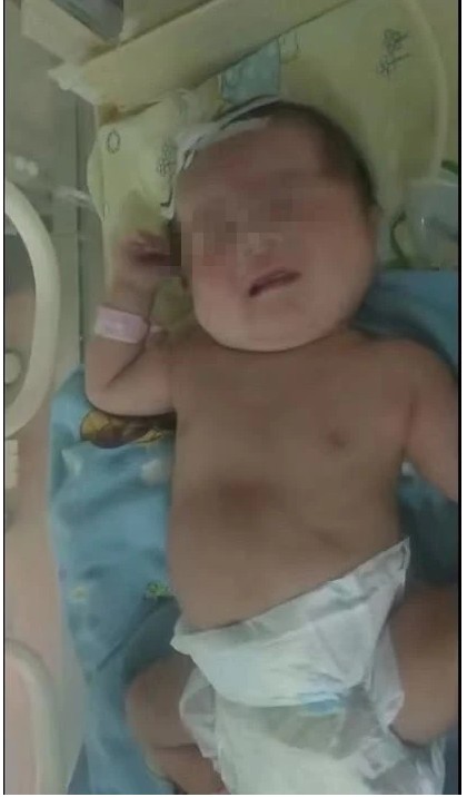 男婴差点被活埋土坑 幸获好心人救起　