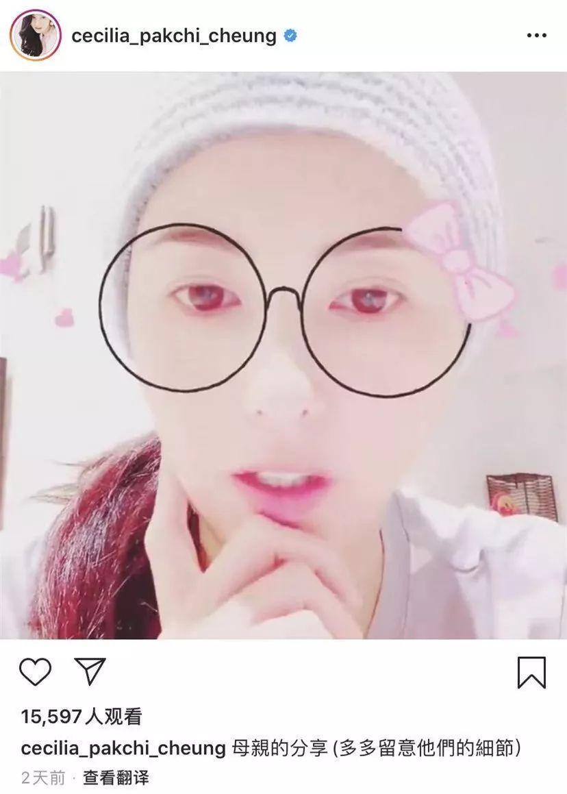 大儿子Lucas打篮球伤到大腿，张柏芝心痛：起码要6个星期才能康复