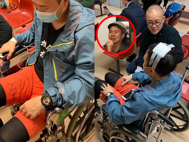 【修例风波】被警扑头伤口7厘米 受伤社工:是向社工尊严狠狠打下去