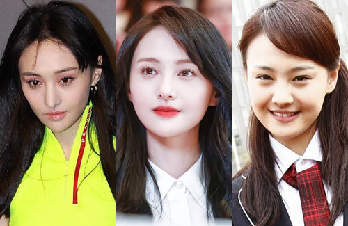 Zheng Shuang’s New Face Spurs Plastic Surgery Rumors