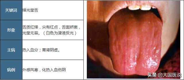 舌诊——绛舌篇，附实例解析