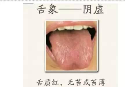 为什么医生要看你的舌头？原来.....