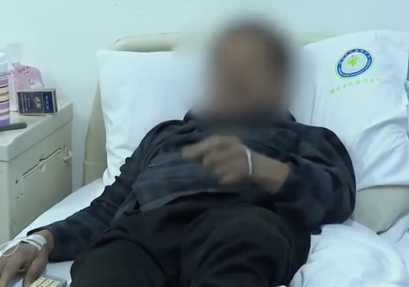 眼镜蛇断头喷毒液　男子左眼被射中险盲