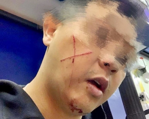 涉上水毁选举横额警脸割交叉 七旬翁续还柙候讯