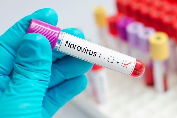 Norovirus warning as bug completely wipes out town closing schools with over a thousand sick