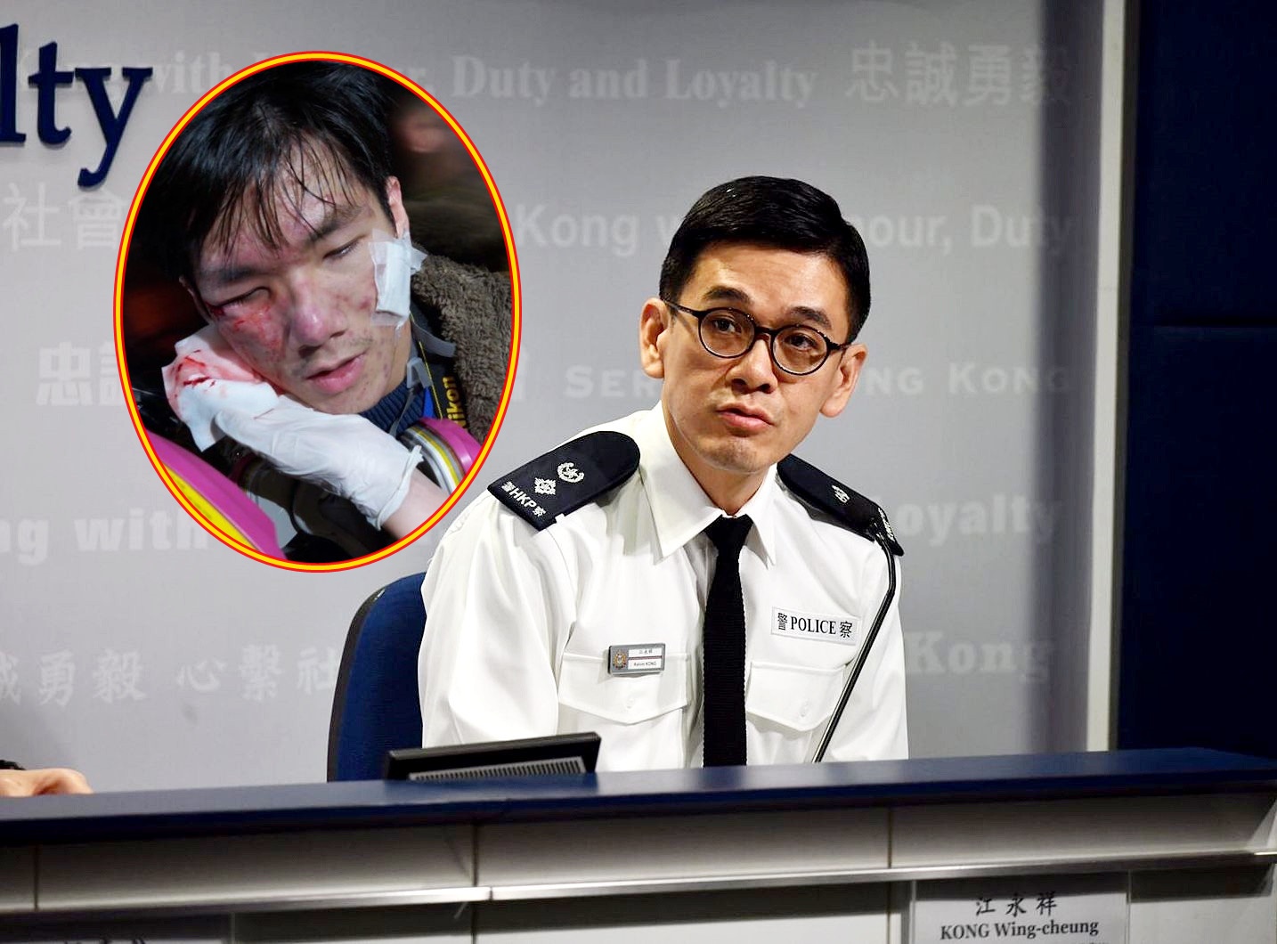 【修例风波】学生记者疑中催泪弹受伤 警：发射方向难免有他人在场