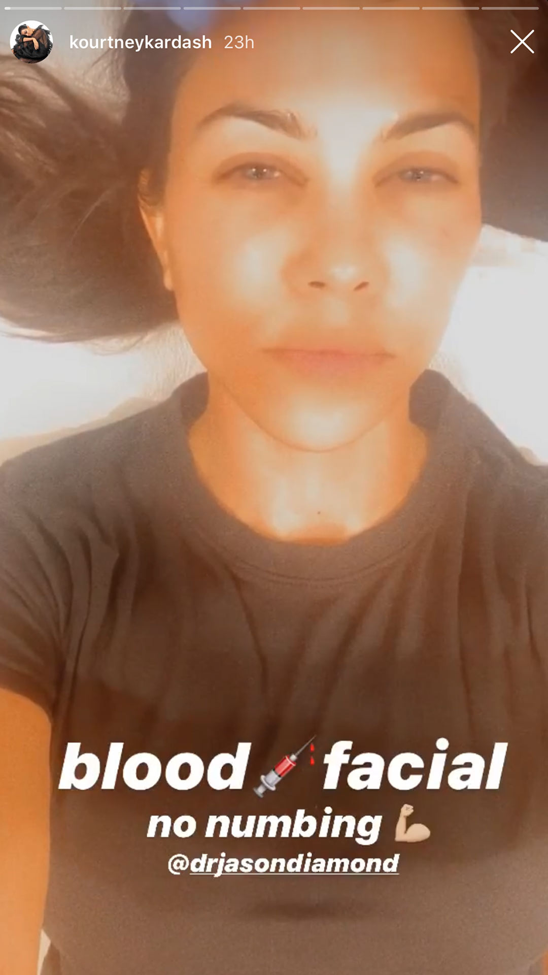 Kourtney Kardashian Gets 'Blood Facial' as Sister Kim Battles Lawsuit Over Vampire Facials