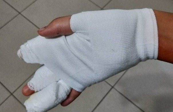 台男生手机摔坏后心情烦躁　持刀斩伤同学