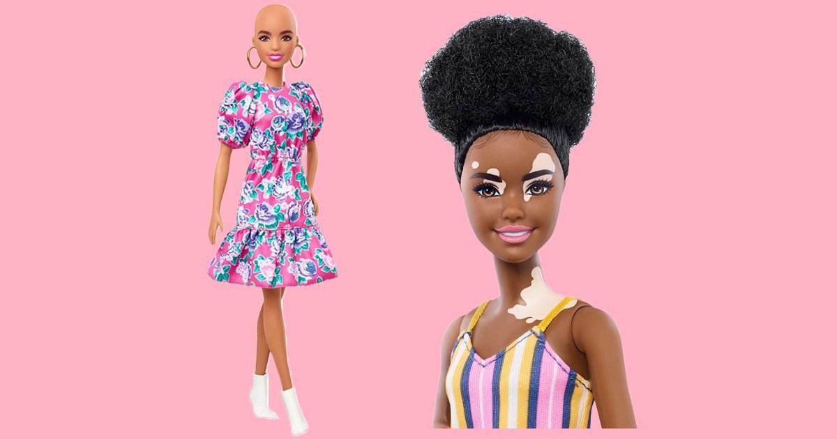 Barbie launches dolls with vitiligo and bald dolls with alopecia