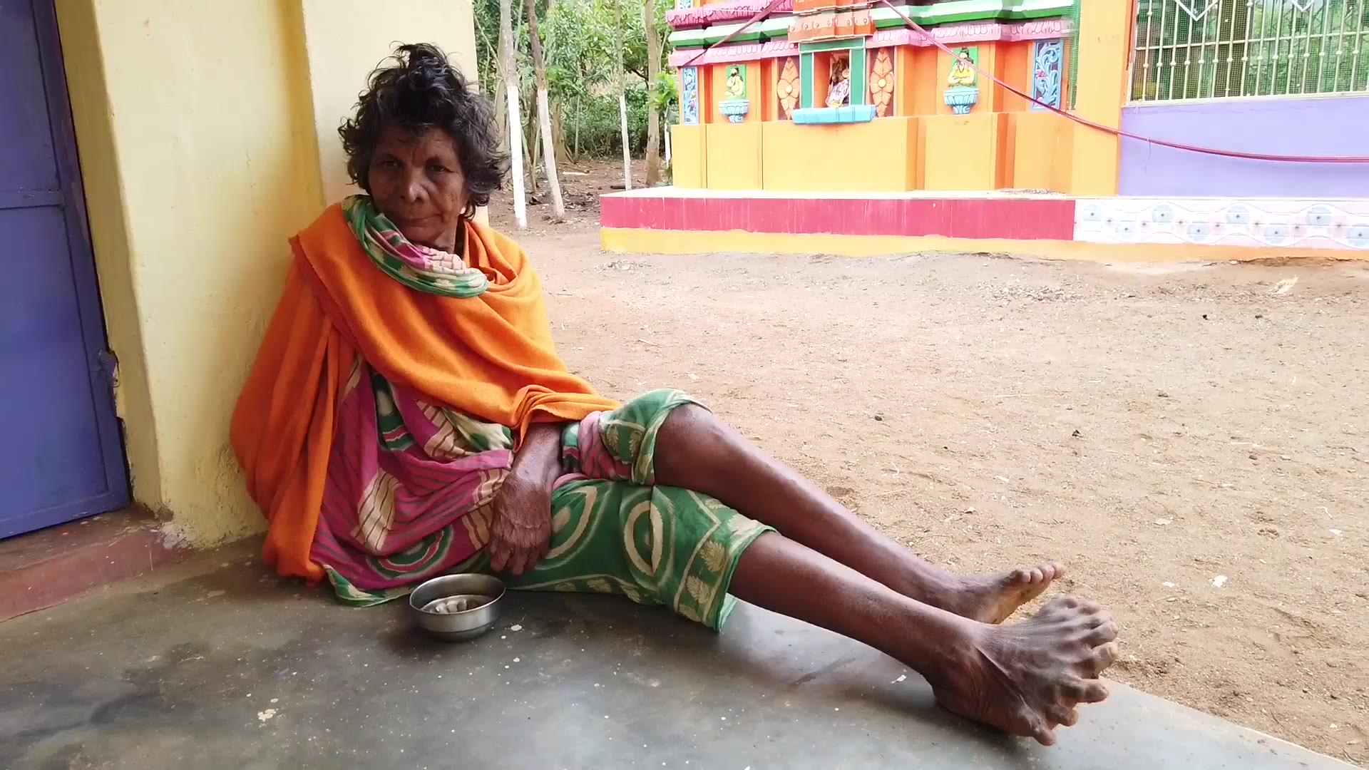 Woman With Record-Breaking 31 Fingers And Toes Says She's Been Branded A 'Witch' By Neighbors