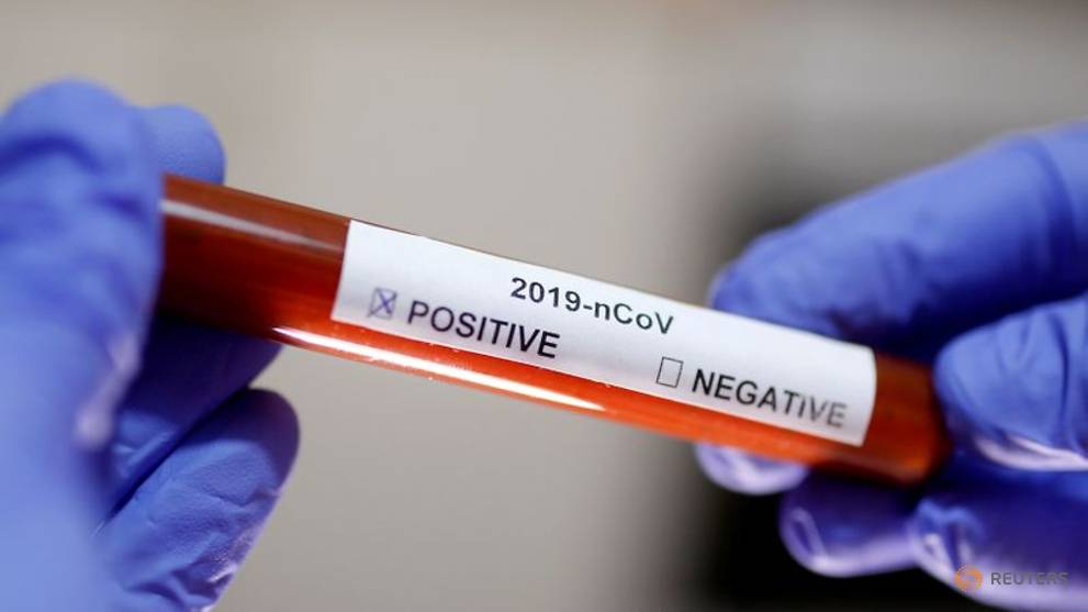 Indonesian health ministry says lab has all needed equipment to detect novel coronavirus