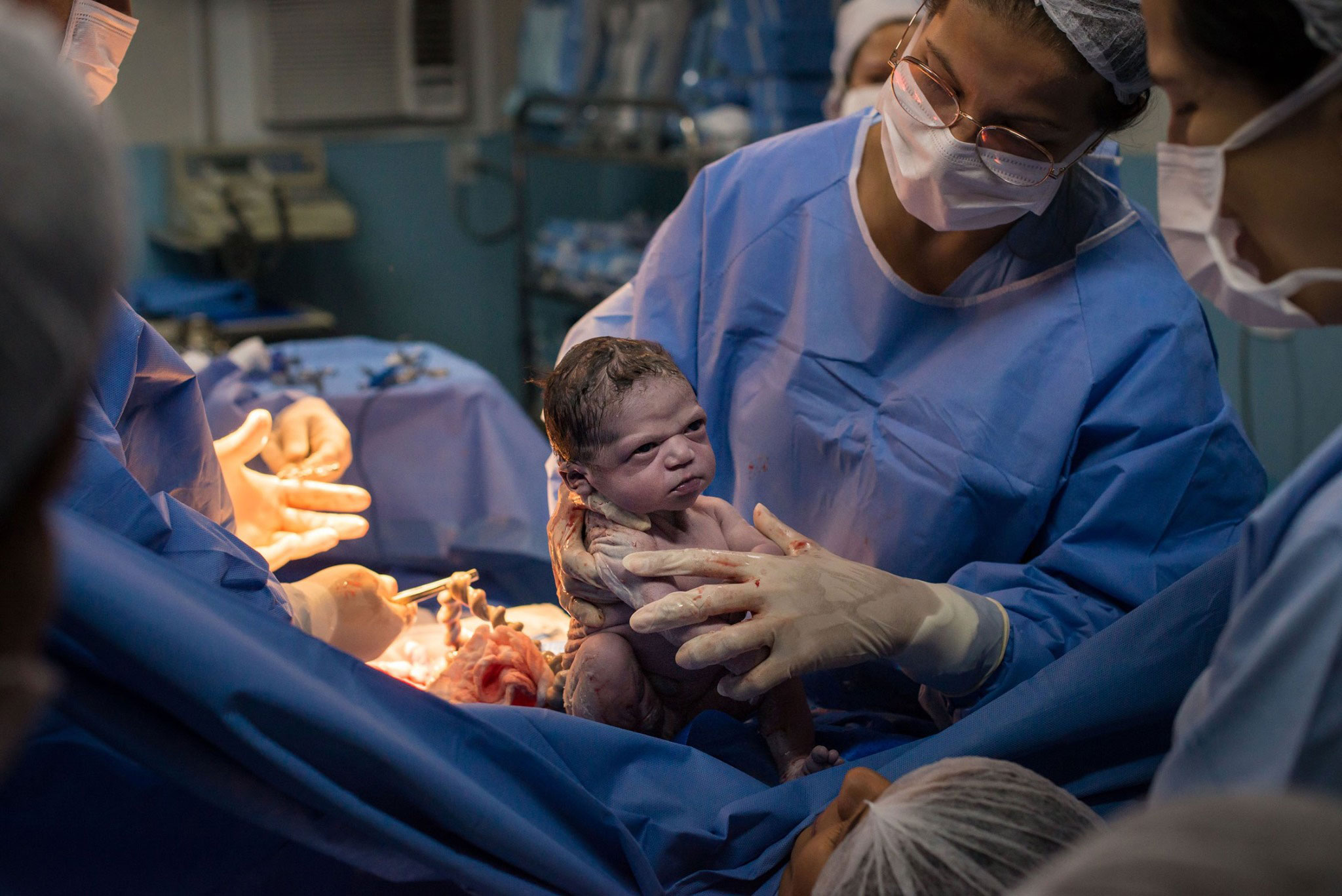 Newborn Baby Goes Viral for Making Hilarious Facial Expression Immediately After C-Section