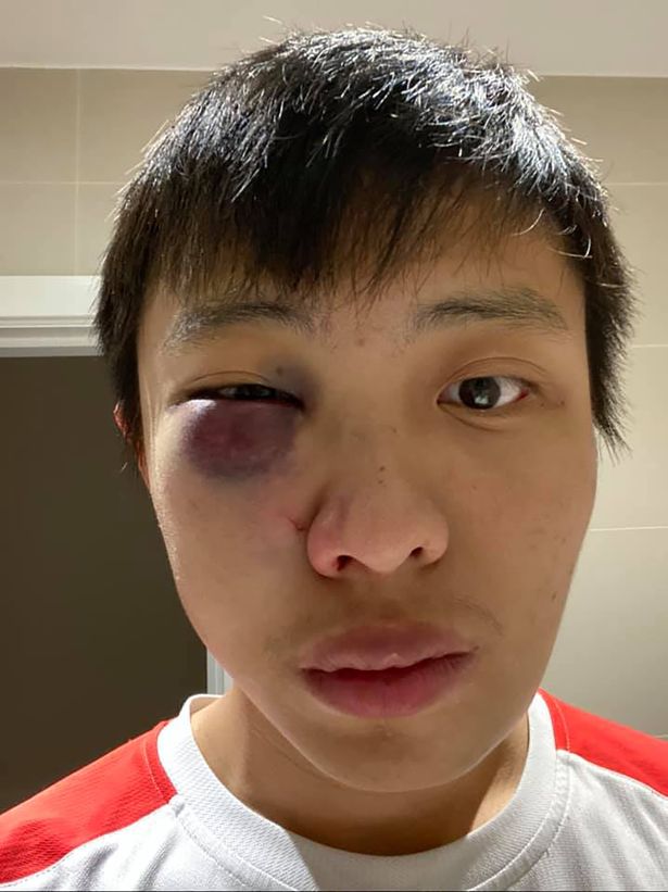 London coronavirus attack as racist gang beat up student for being from Singapore