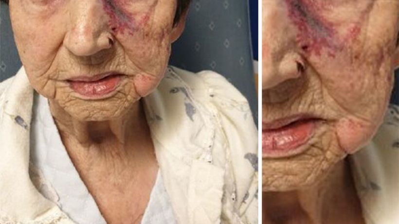 Liverpool police chief wants to catch 'scum' who burgled woman, 93