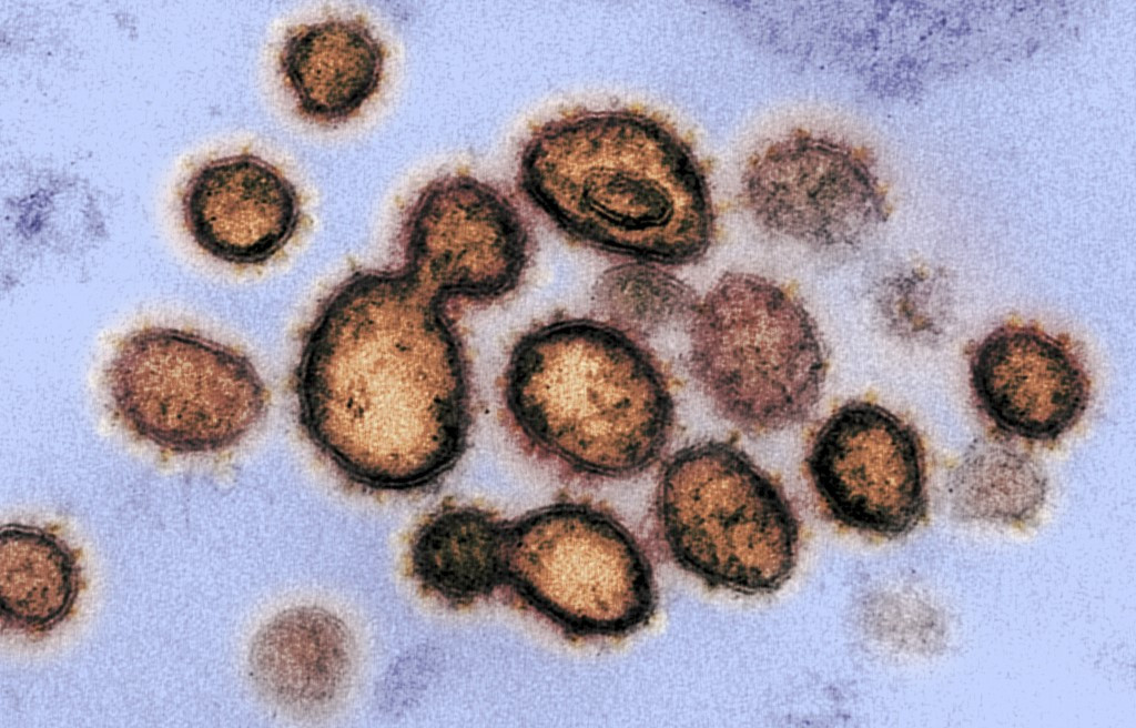 Cyprus' largest hospital suspends services after doctor contracts coronavirus