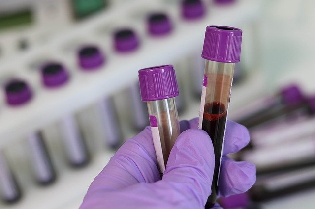 This new Coronavirus testing kit from India claims to deliver results in 2.5 hours
