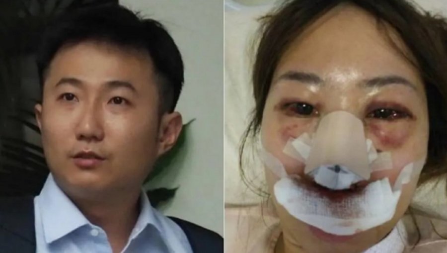 求欢不成暴打女友　医生欲借“醉”脱罪不果