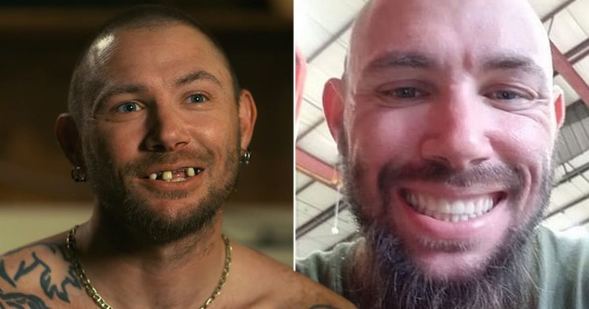 Tiger King Joe Exotic’s ex-husband John Finlay shows off sparkling set of new teeth after filming Netflix hit