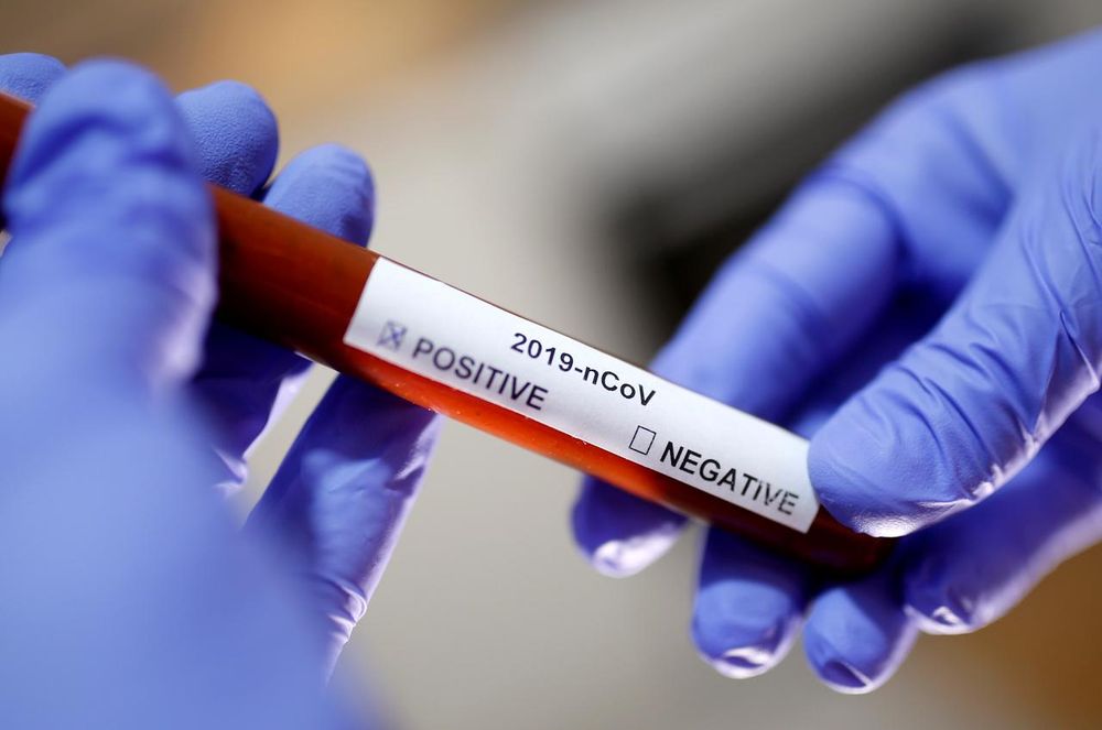 Papua New Guinea reports 144 new Covid-19 cases amid slow vaccination rollout