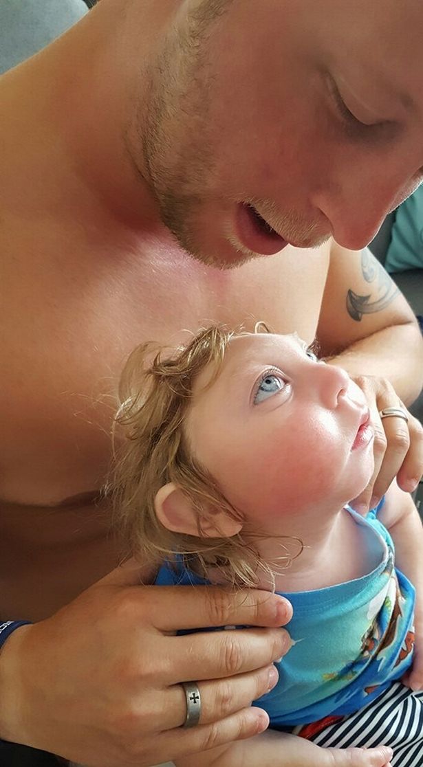 Baby who defied the odds after being born with most of skull missing dies
