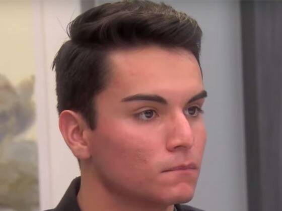 A Dog Bite Victim Opens Up About Growing Up With a Disfigured Nose on Botched