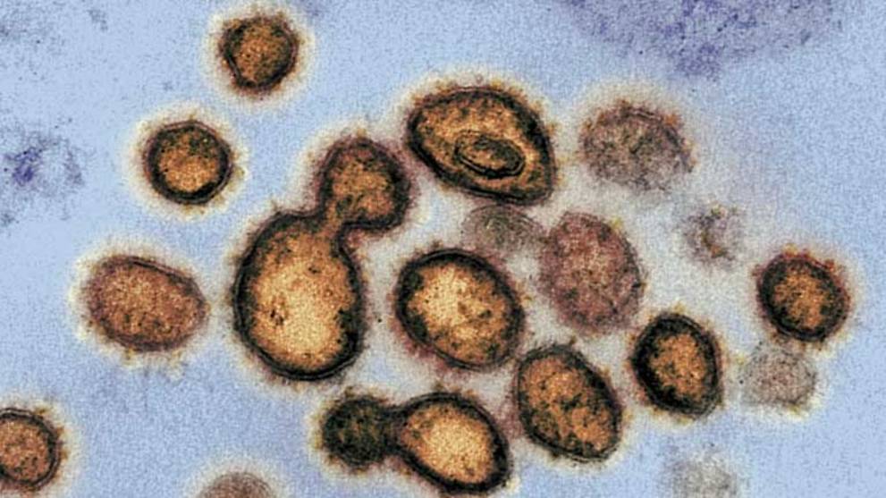 Israel isolates coronavirus antibody in 'significant breakthrough': Minister