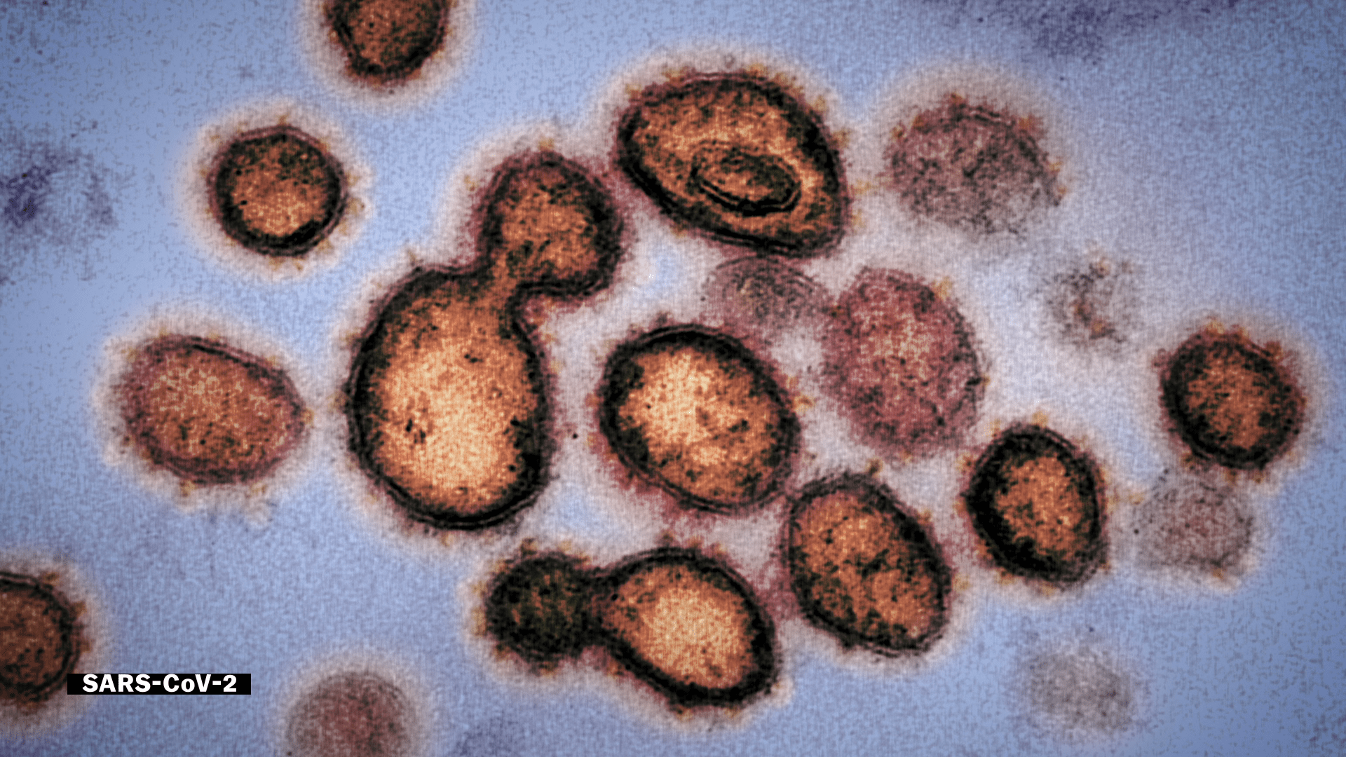 Coronavirus explained: How Covid-19 spreads and what makes it so ‘deviant’