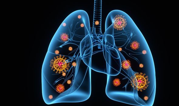 Scans reveal true horror of how coronavirus can seriously damage patients’ lungs in days
