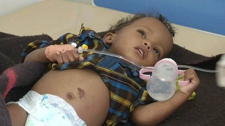 Yemen's cholera outbreak worsens amid Coronvirus fears; 110,000 new cases recorded since January