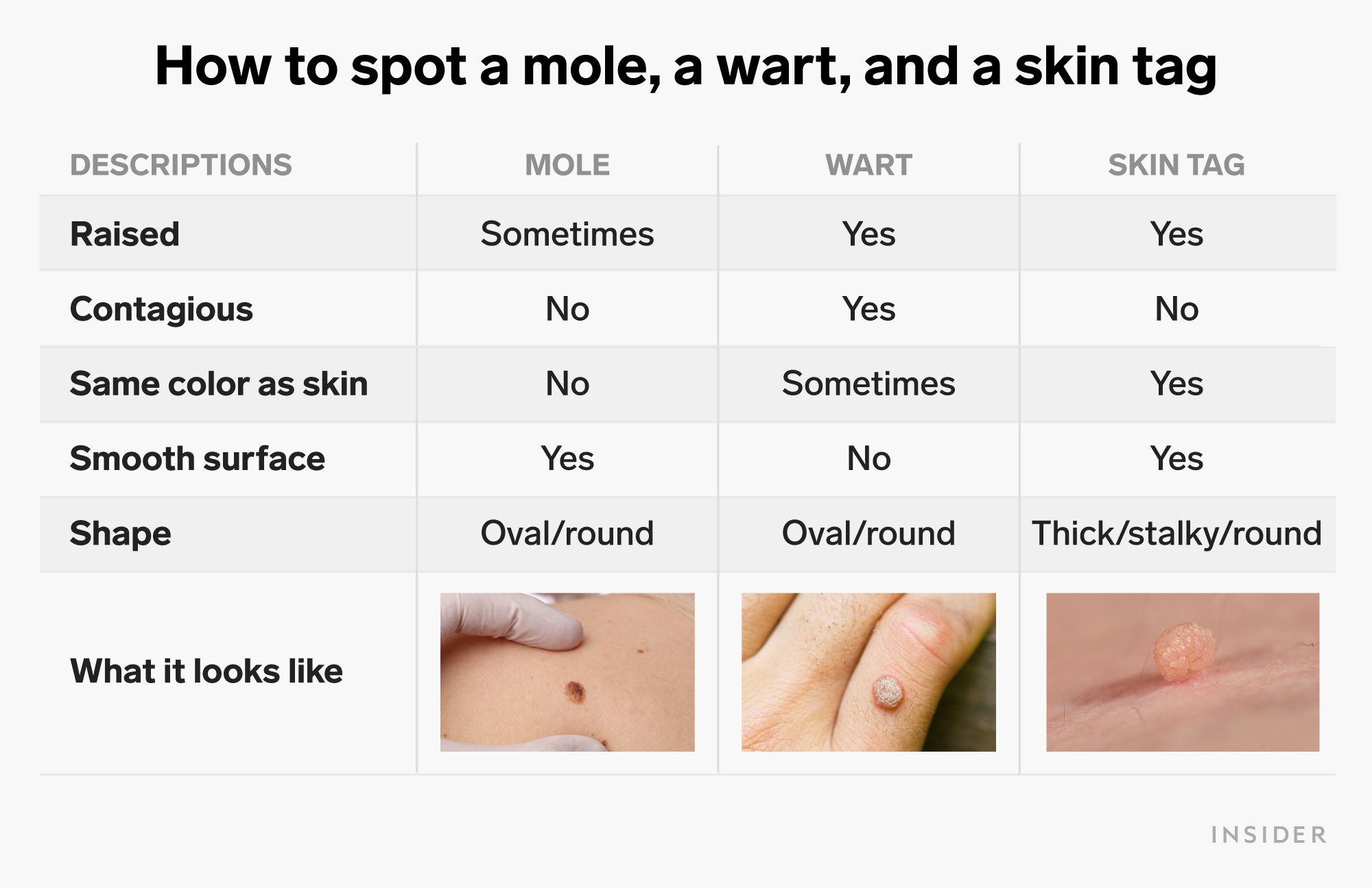 How to get rid of warts with duct tape and other at-home methods