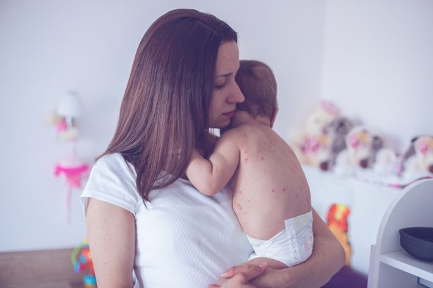 Deadly child fever linked to coronavirus could be delayed response, experts warn