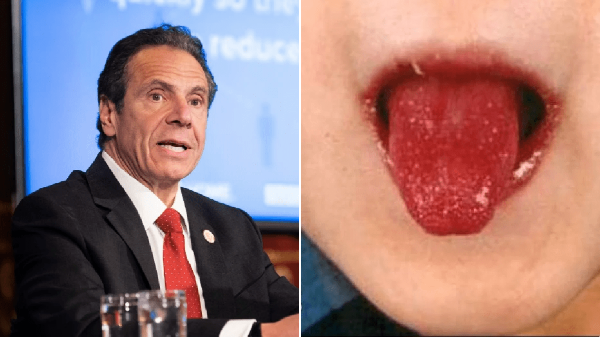 Number of kids with coronavirus-related inflammatory disease rises by 10% in New York