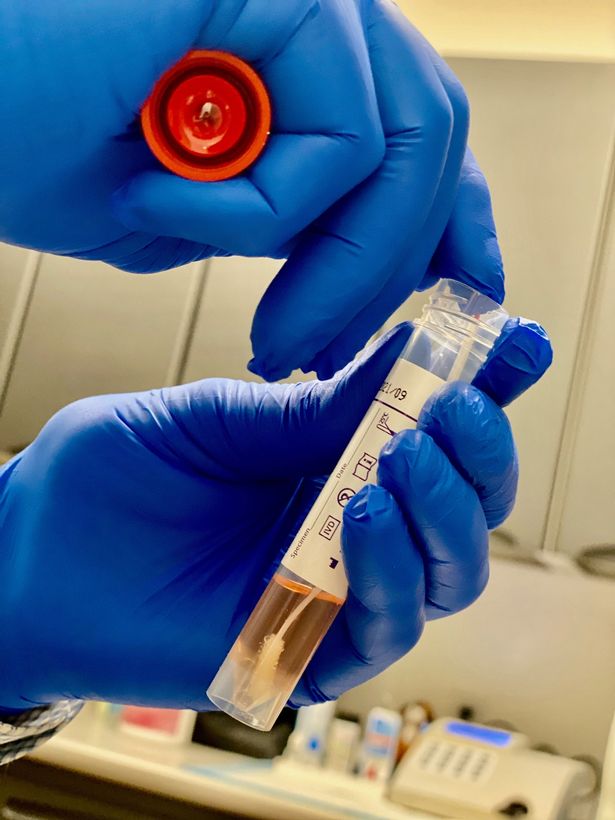 How 'game-changer' coronavirus antibody test could be rolled out to end lockdown