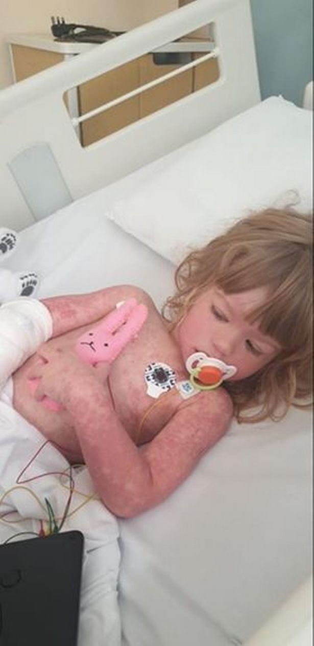 Mum claims girl, 3, had 'terrifying' Kawasaki disease linked to coronavirus a year ago