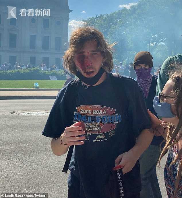白人男子被催泪弹打瞎一只眼：这点痛相比不算啥